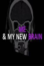 Watch Me & My New Brain 9movies