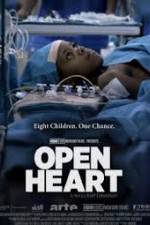 Watch Open Heart 9movies