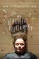 Watch My Beautiful Broken Brain 9movies