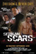 Watch Serbian Scars 9movies